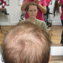 before treatment