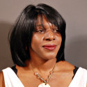 after Hair Replacement  treatment