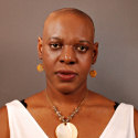 before Hair Replacement  treatment