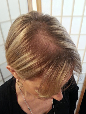 Jacquie before