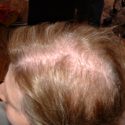 before hair treatment
