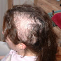 before treatment