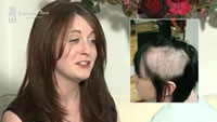 When did you first start pulling your hair