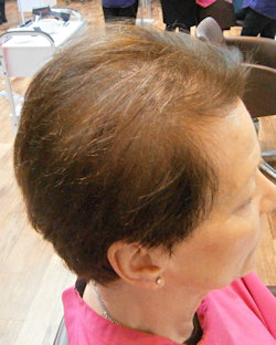 Client B before