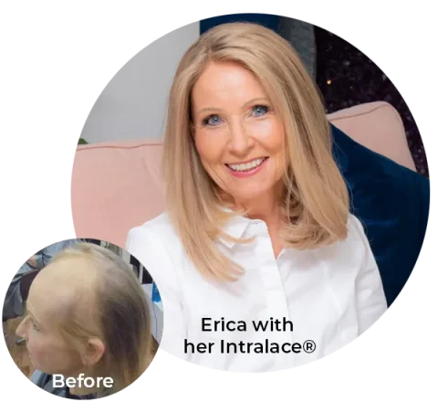 Erica