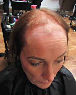 Rachel before