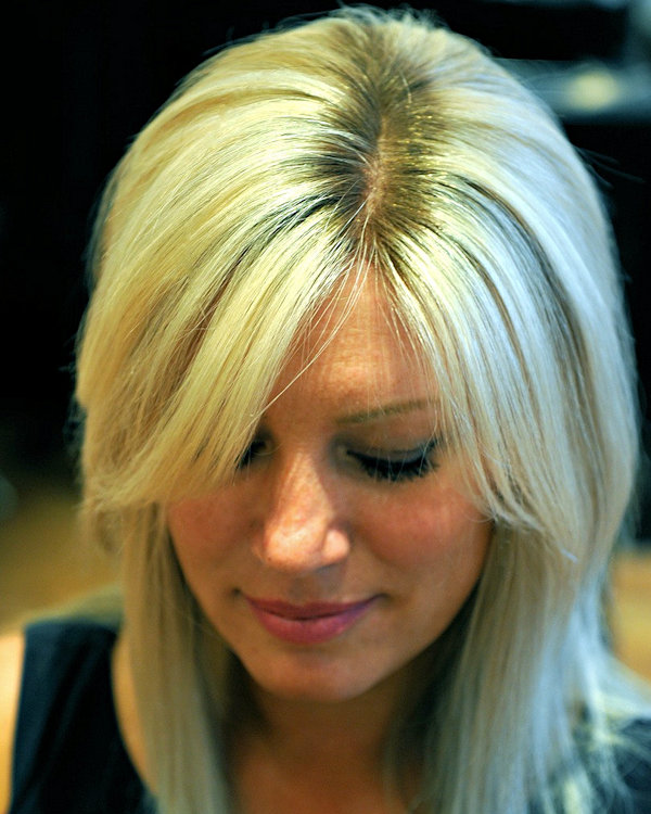 Additional before and after photos of Rachel - Intralace 