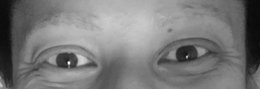 eyebrows