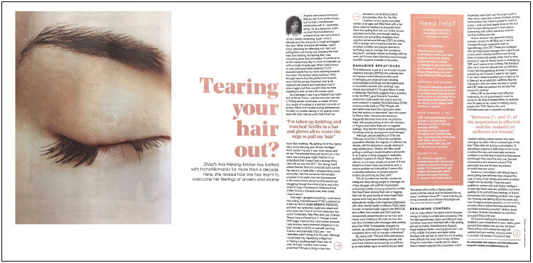 Article about Trichotillomania